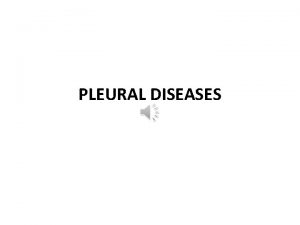 PLEURAL DISEASES Pleural Effusion Incidence 300 cases 100