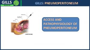 I GILLS PNEUMOPERITONEUM ACCESS AND PATHOPHYSIOLOGY OF PNEUMOPERITONEUM