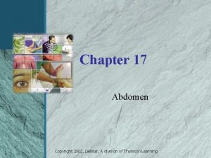 Chapter 17 Abdomen Copyright 2002 Delmar A division