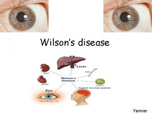 Wilsons disease Yannier What is it Autosomal recessive