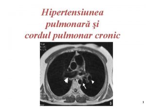 Hipertensiunea pulmonar i cordul pulmonar cronic 1 Numrul