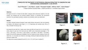 STIMROUTER FOR TREATMENT OF POSTSURGICAL OMALGIA REFRACTORY TO