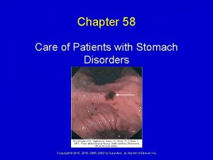 Chapter 58 Care of Patients with Stomach Disorders