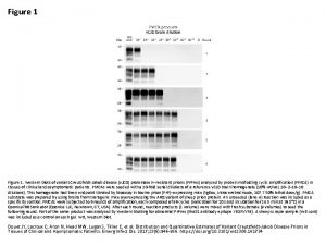 Figure 1 Western blots of variant CreutzfeldtJakob disease