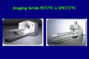 Imaging ibrido PETTC o SPECTTC Acquisizione con gammacamera