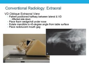 Conventional Radiology Extraoral VD Oblique Extraoral View Patient