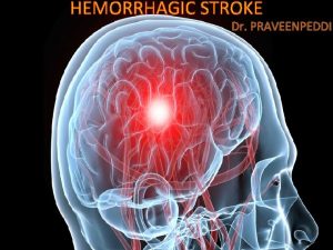 HEMORRHAGIC STROKE INTRODUCTION STROKE ISCHEMIC 80 HEMORRHAGIC 20