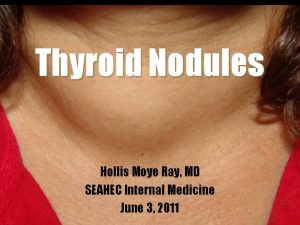 Thyroid Nodules Hollis Moye Ray MD SEAHEC Internal