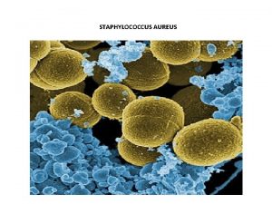 STAPHYLOCOCCUS AUREUS STAPHYLOCOCCUS AUREUS es una bacteria anaerobia