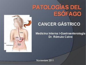 PATOLOGAS DEL ESFAGO CANCER GSTRICO Medicina Interna IGastroenterologa