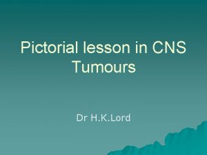 Pictorial lesson in CNS Tumours Dr H K