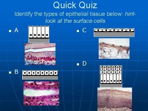 Quick Quiz Identify the types of epithelial tissue