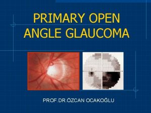 PRIMARY OPEN ANGLE GLAUCOMA PROF DR ZCAN OCAKOLU