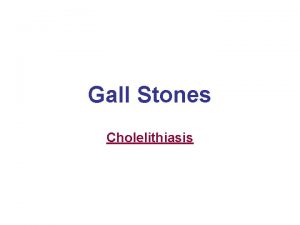Gall Stones Cholelithiasis Cholelithiasis Definition Most common biliary