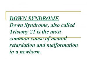 DOWN SYNDROME Down Syndrome also called Trisomy 21