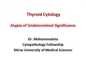 Thyroid Cytology Atypia of Undetermined Significance Dr Mohammadnia Thyroid Cytology Atypia of Undetermined Significance Dr Mohammadnia